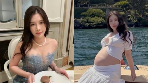 鄭家純懷孕被老公「要求做1事」!她傻眼:嘴巴控制一下 驚爆「挨了上百針」