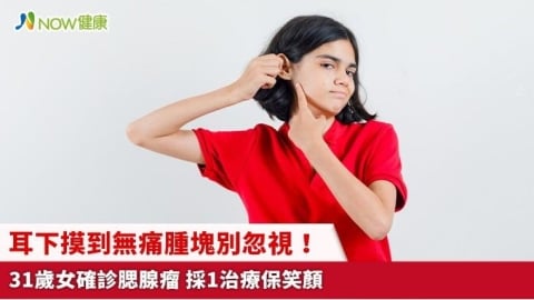 耳下摸到無痛腫塊別忽視!31歲女確診腮腺瘤 採1治療保笑顏