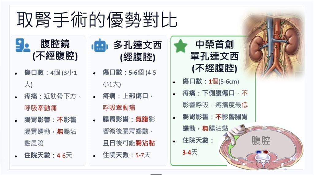 鶼鰈情深！不捨尪洗腎受苦　妻「達文西手術」捐腎救夫大成功