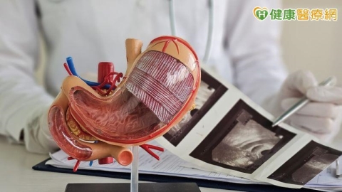 健檢揪出「胃腸道基質瘤」!無痛微創切除化解惡性腫瘤