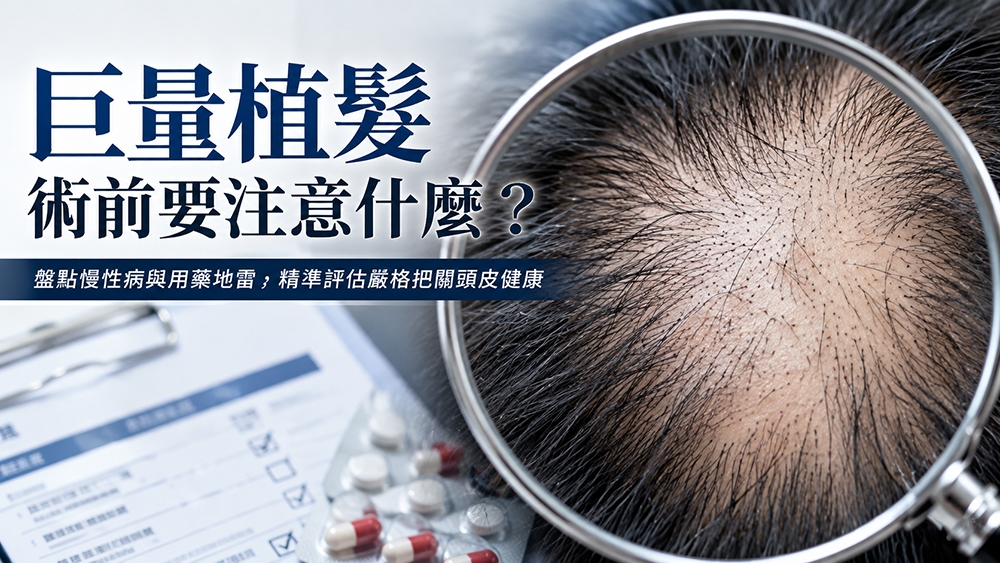 巨量植髮術前要注意什麼?盤點慢性病、用藥與生活習慣等評估重點