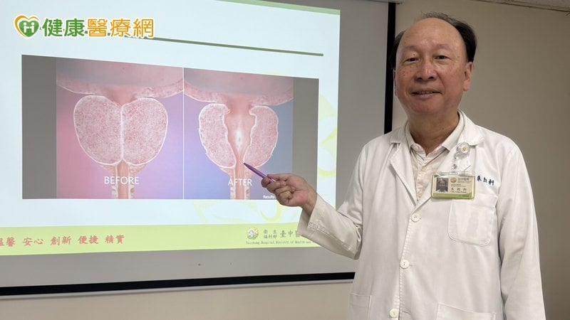 57歲企業主頻尿、解尿卡 醫提醒:攝護腺肥大恐拖累膀胱又傷腎