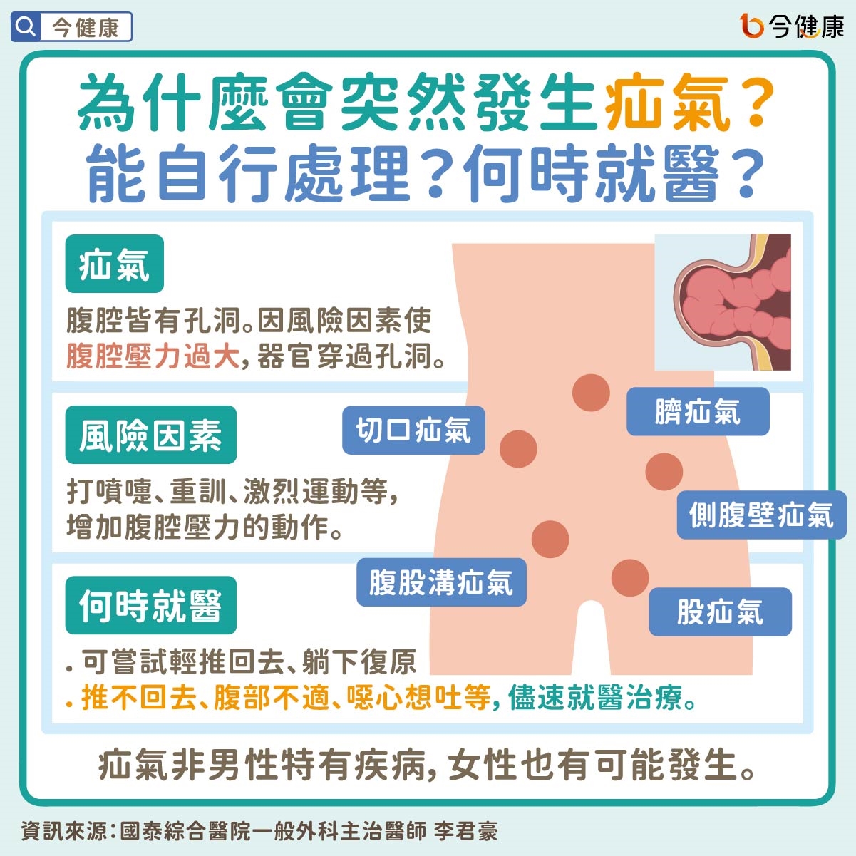 為什麼會突然發生疝氣?能自行處理?何時就醫?