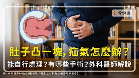 肚子凸一塊,疝氣怎麼辦?能自行處理?有哪些手術?外科醫師解說!