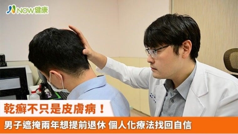 乾癬不只是皮膚病!男子遮掩兩年想提前退休 個人化療法找回自信