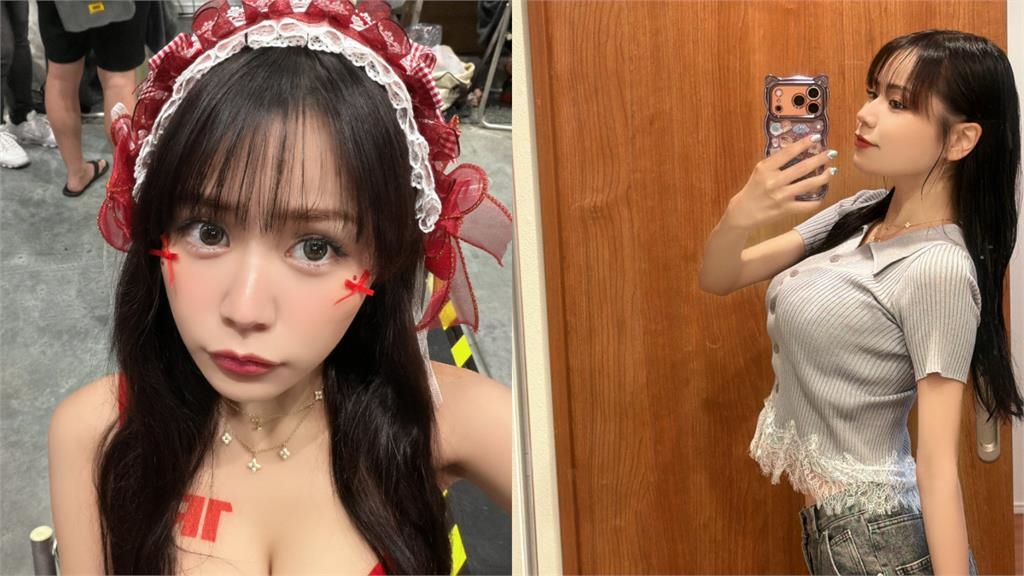 暗黑女神「被酸肥豬」生病暴瘦剩39KG!驚人對比照曝光:不再讓人說我噁心
