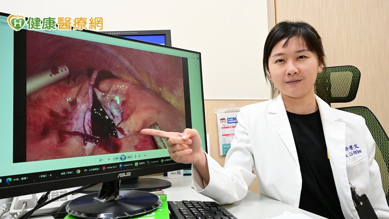 車禍「肝臟囊腫」破裂 男子大出血險喪命