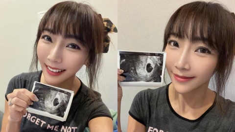 42歲資生堂千金懷「第6寶」!首度自然懷孕驚呼:人生巨大驚喜