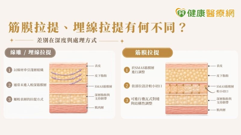 筋膜拉提「不是線雕」!醫解析筋膜拉提評估重點與適用族群