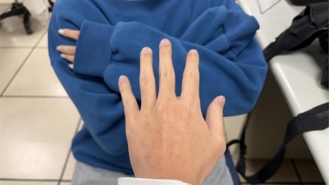 女高中生月經沒來!醫一看嚇壞「體內有兩顆睪丸」還是男性XY染色體
