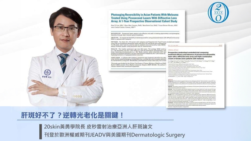 肝斑為什麼容易反覆?從黑色素到肌膚環境認識常見影響因素
