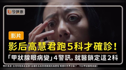 【影片】影后高慧君跑5科才確診!眼凸、模糊「甲狀腺眼病變」4警訊,就醫鎖定這2科