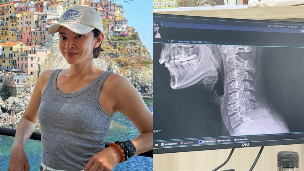連筷子都拿不穩!48歲女星驚爆「中風前兆」急奔醫院 真實病況曝光