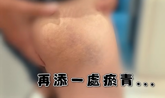 蔡阿嘎在日本被打!慘遭店員「賞巴掌、揍肚子」全被拍 畫面流出網嚇:好痛