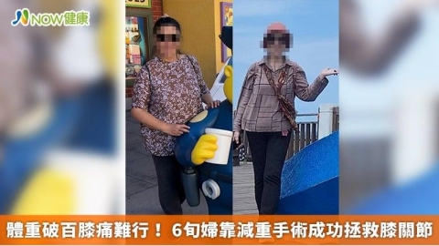 體重破百膝痛難行! 6旬婦靠減重手術成功拯救膝關節