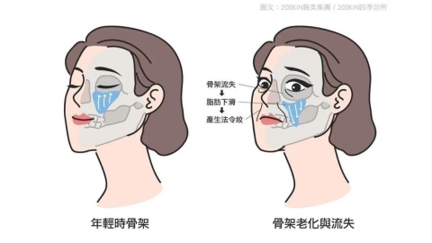 法令紋為什麼越來越明顯？從骨骼、軟組織到表情活動認識常見成因