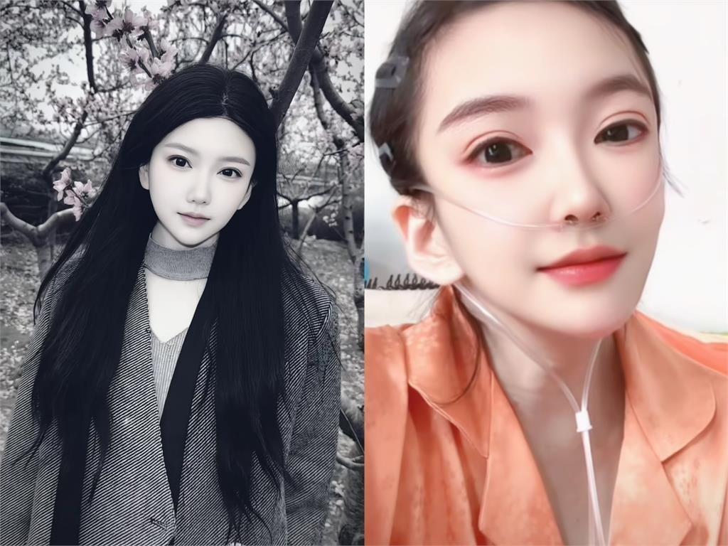 中國網紅不敵病魔逝世…曾悲喊「不想堅持了」 前夫不離不棄守到最後