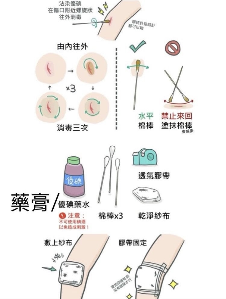 傷口只有2個針孔，手指卻彎不起來？醫師提醒：手部處置後別只看表面