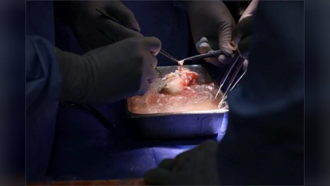 他先移植豬腎逃離洗腎地獄9個月　成功等到人類器官迎新生