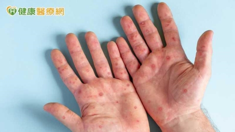 開學腸病毒緩升！未滿5歲男童染D68型重症　全身無力、嗜睡送加護