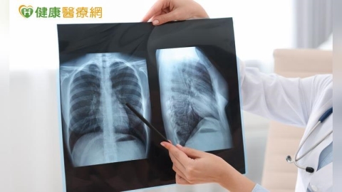 晚期肺癌治療進入組合療法時代 醫:第一線治療策略攸關後續布局