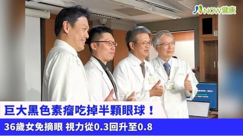 巨大黑色素瘤吃掉半顆眼球！36歲女免摘眼 視力從0.3回升至0.8