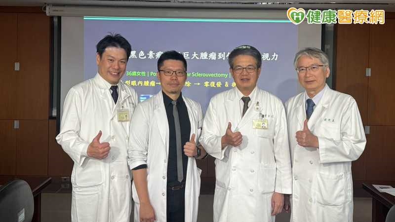 36歲女視力模糊揪2公分眼內腫瘤 北榮醫談脈絡膜黑色素瘤治療選擇