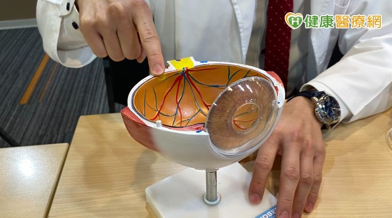 眼底竟長惡性腫瘤!4旬港男跨海求醫 長庚醫:症狀易與常見眼疾混淆