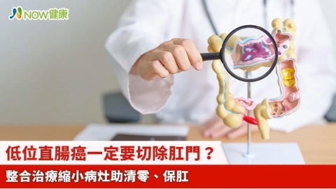 低位直腸癌一定要切除肛門? 整合治療縮小病灶助清零、保肛