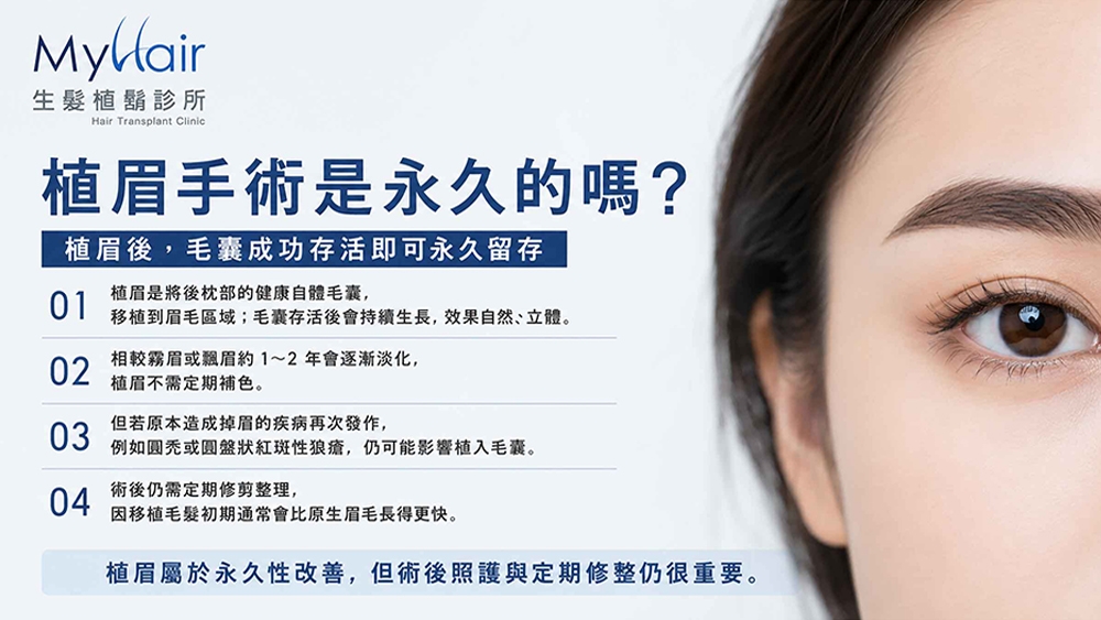 圖說:MyHair生髮植鬍診所-劉彥均醫師:植眉是將自體毛囊移植至眉毛區域,實際毛囊存活、生長狀況與維持時間會因個人條件而異,術後仍應依醫師指示進行照護。