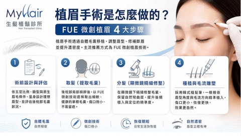 眉毛稀疏、斷眉怎麼辦?認識植眉手術四大步驟與術前評估重點