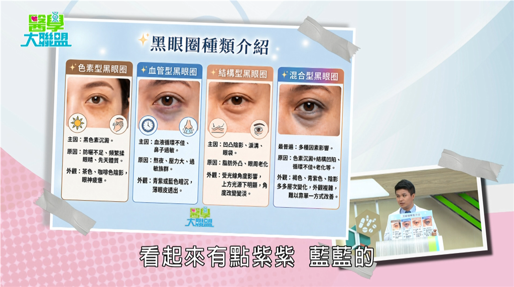 秀秀子《醫學大聯盟》黑眼圈成因大解密! 專家曝四大類型:妳是哪一種!