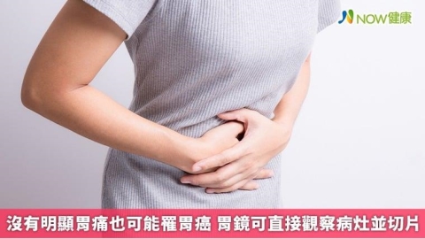 沒有明顯胃痛也可能罹胃癌 胃鏡可直接觀察病灶並切片