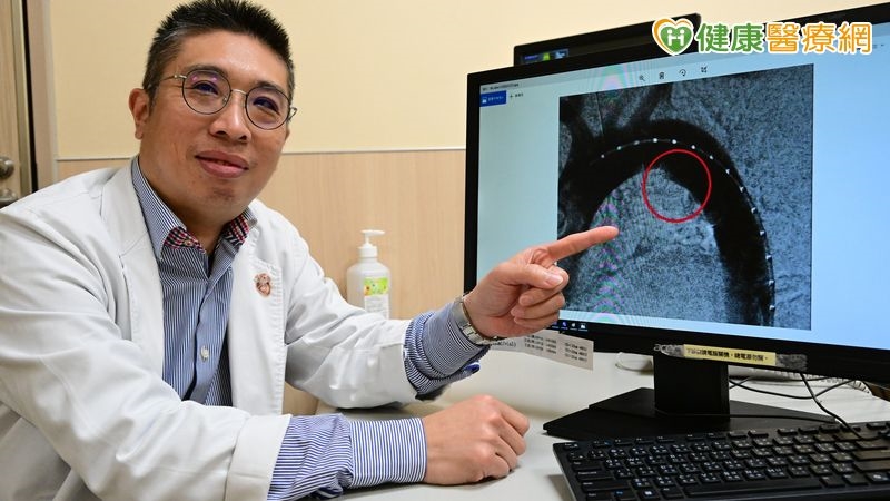 名醫胸痛延伸右胸!機智自救 醫揭穿透性主動脈潰瘍及時挽救寶貴生命