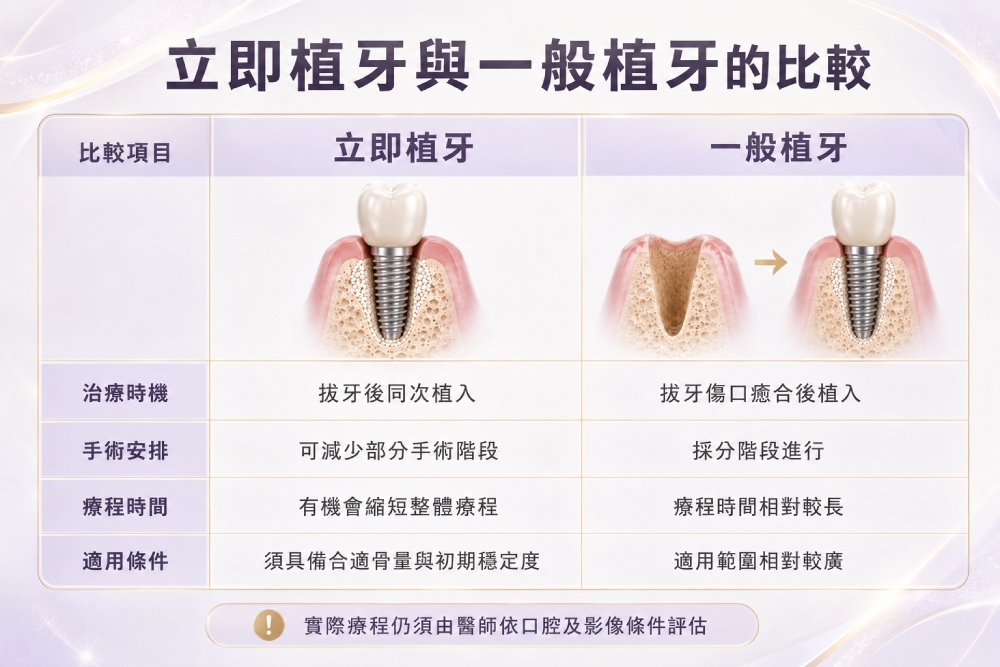 拔牙當天就能植牙?醫師揭「立即植牙」不是人人都適合 4 拔牙當天就能植牙?醫師揭「立即植牙」不是人人都適合 3