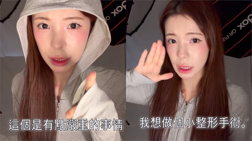 李多慧認了想動「第一次手術」!翻3年前舊照對比崩潰喊:真的超級嚴重