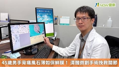 45歲男手背痛風石薄如保鮮膜! 清醒微創手術挽救關節