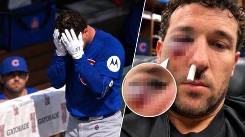 MLB(影)/恐怖界外球直擊臉部!布萊格曼左眼腫到睜不開 自拍喊「我會回來」