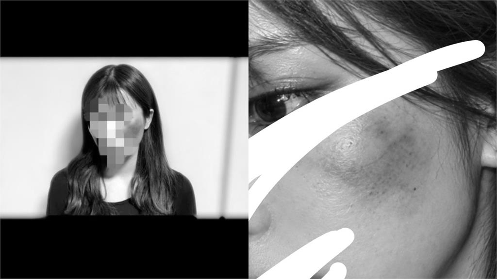 男團偶像涉嫌施暴女友!她「滿臉是血」衝超商求救…發傷勢照喊:心裡的傷痛更痛