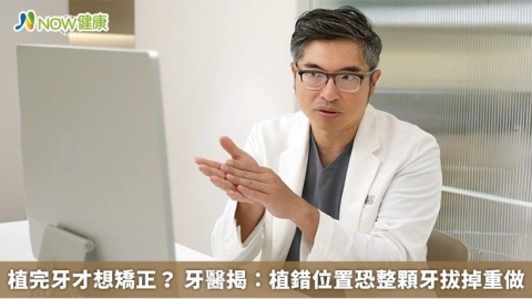植完牙才想矯正？ 牙醫揭：植錯位置恐整顆牙拔掉重做