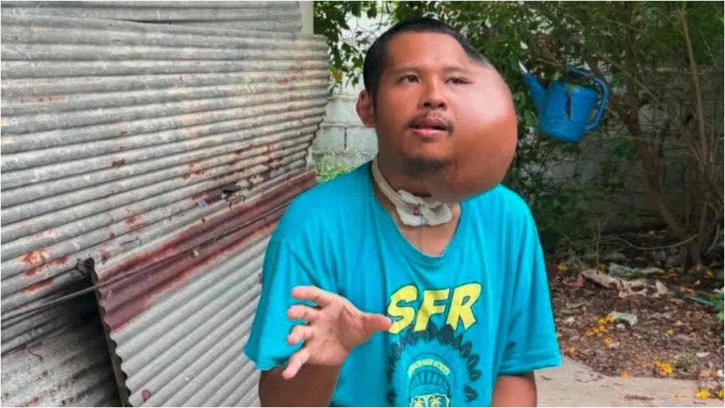 男長期拿1硬物「掏洞」下場超慘!這部位「腫出超巨一顆」震撼畫面曝