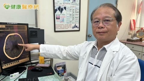 長者走路像「黏在地上」還尿失禁 小心「交通性水腦症」作祟