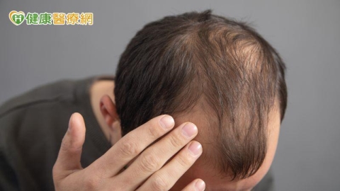 37歲男頭髮愈來愈少以為雄性禿!抽血揪「真正原因」 竟是缺這營養素
