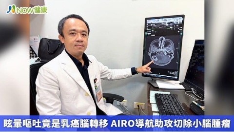 眩暈嘔吐竟是乳癌腦轉移 AIRO導航助攻切除小腦腫瘤