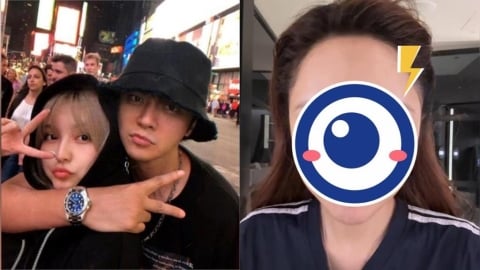 周揚青突認了「臉腫+饅化」疑整型後遺症!素顏片流出 網驚:好像羅志祥…