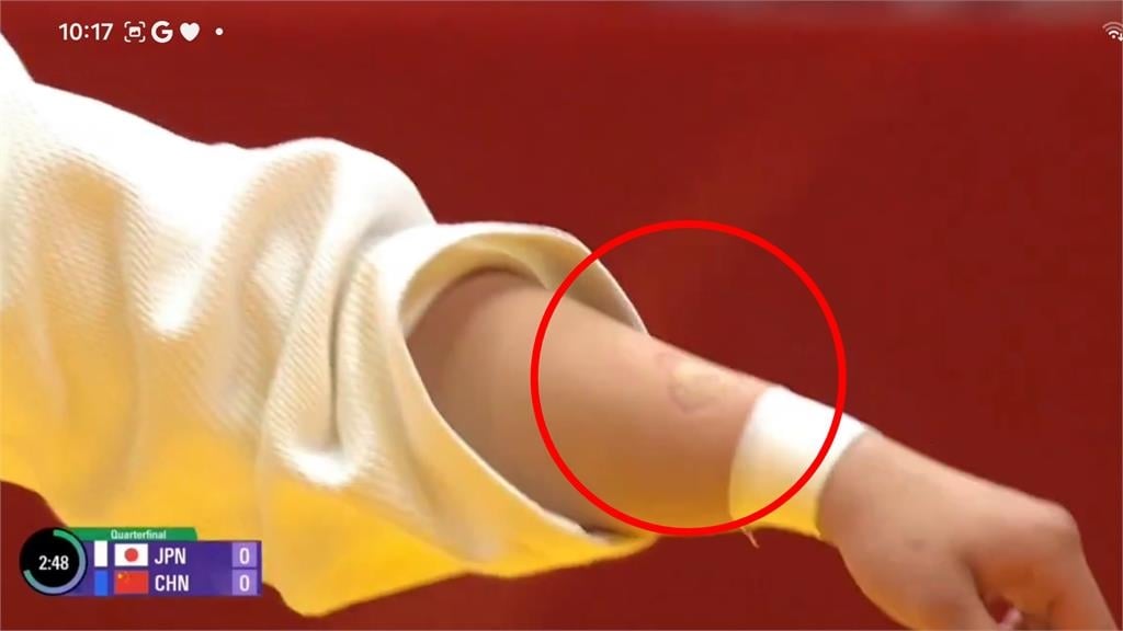 亞運柔道中國女將竟「死不鬆嘴」咬傷日選手！「心型齒痕」全被拍…超慘下場曝光
