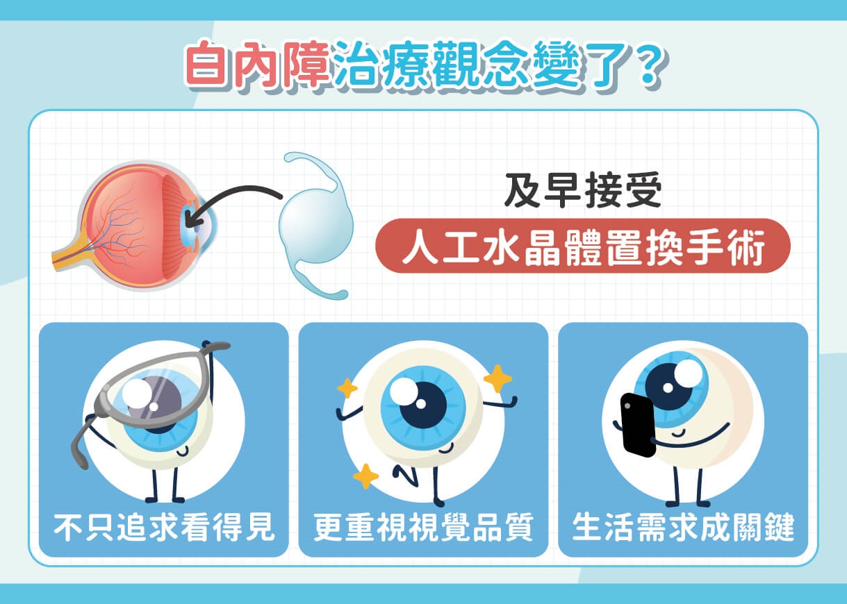 白內障只求「看得見」就夠了？醫揭人工水晶體怎麼選：術後視力品質更重要