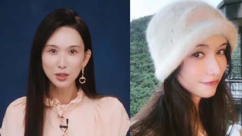 51歲林志玲素顏「電眼消失」網驚認不出!整形醫揭「2變化」對比圖曝光