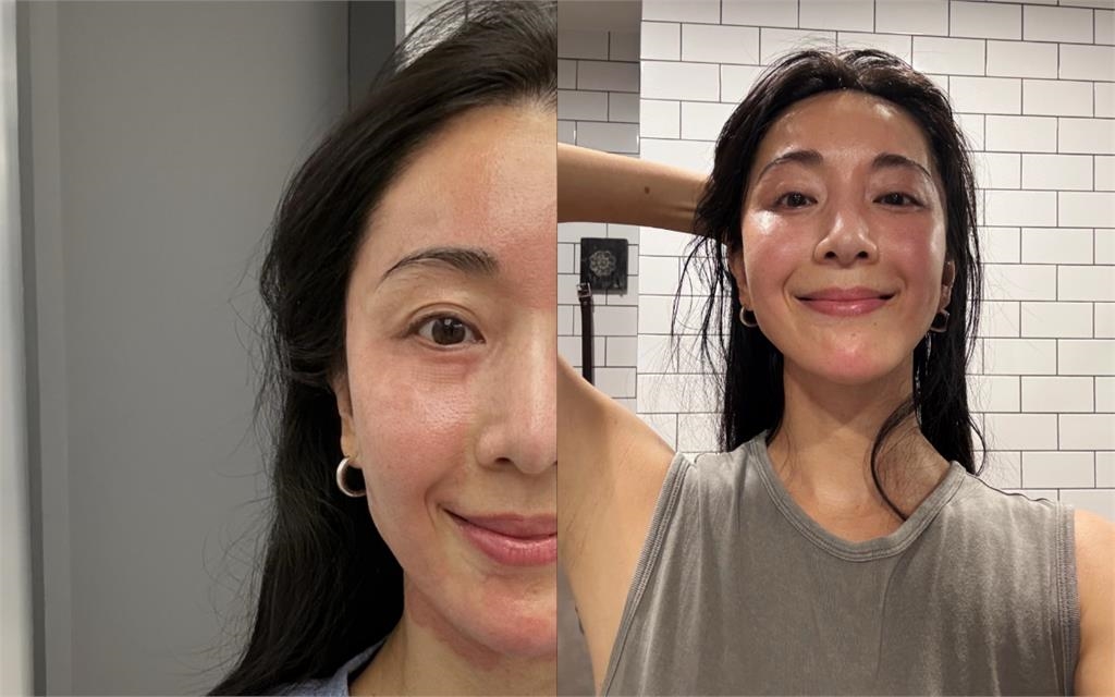 隋棠爆「倍速老化」認了做醫美!術後「素顏真面目」曝光:肉眼可見差異