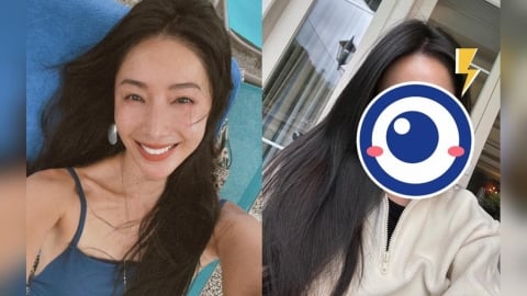 隋棠爆「倍速老化」認了做醫美!術後「素顏真面目」曝光:肉眼可見差異